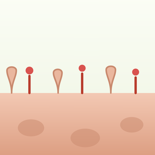 Perete intestinal permeabil